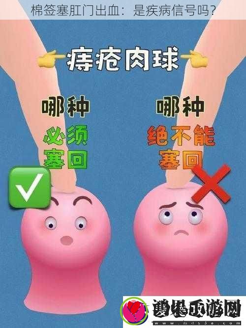 棉签塞肛门出血